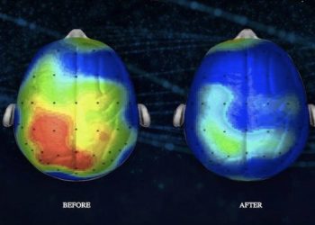 Neuroscientists Discover A Song That Can Reduce Anxiety By 65 Percent (Listen)